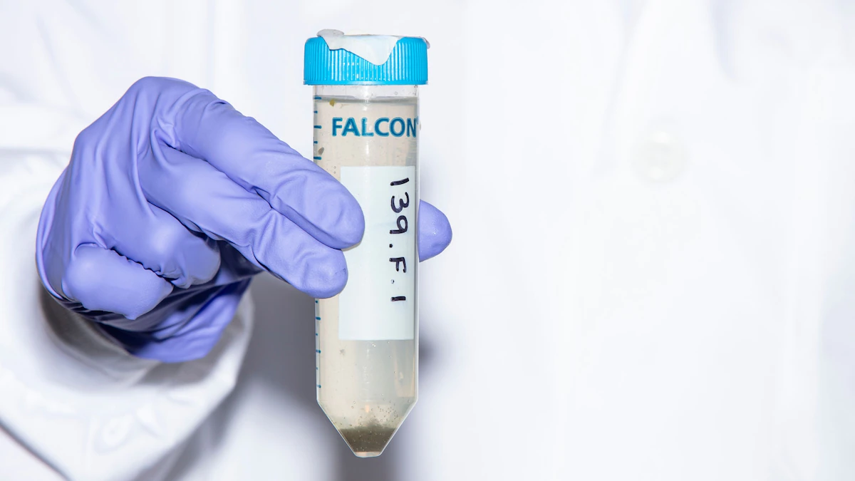 One of the best tools for predicting COVID-19 outbreaks? Sewage. 1 One of the best tools for predicting COVID-19 outbreaks? Sewage.